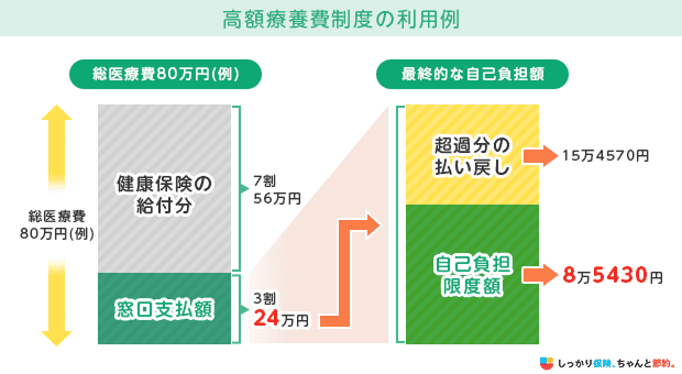 高額療養費制度の利用例