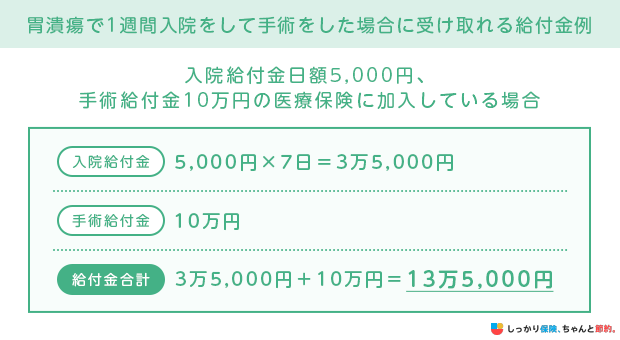 胃潰瘍で1週間入院をして手術をした場合に受け取れる給付金例
